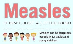 Measles